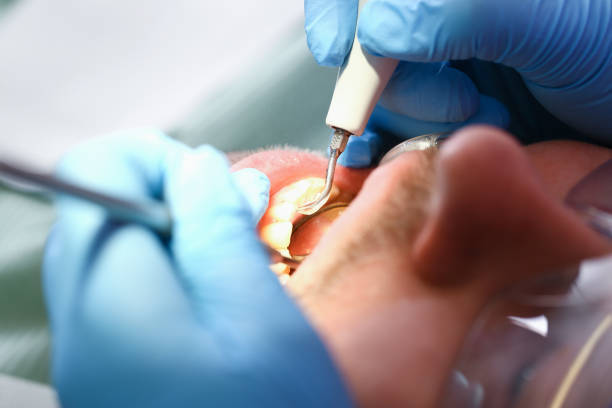 Best Emergency Treatment for Toothache in New Whiteland, IN