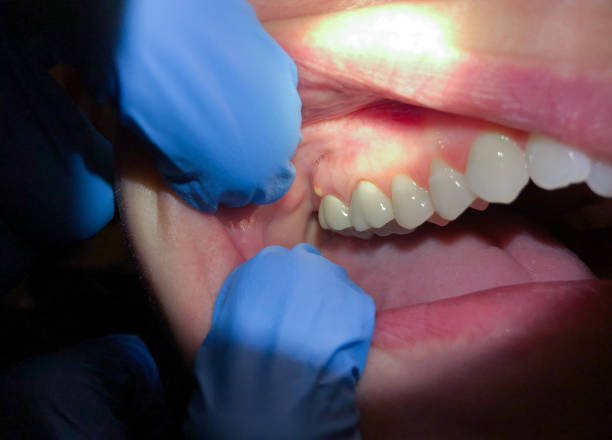 Best Urgent Dental Care in New Whiteland, IN